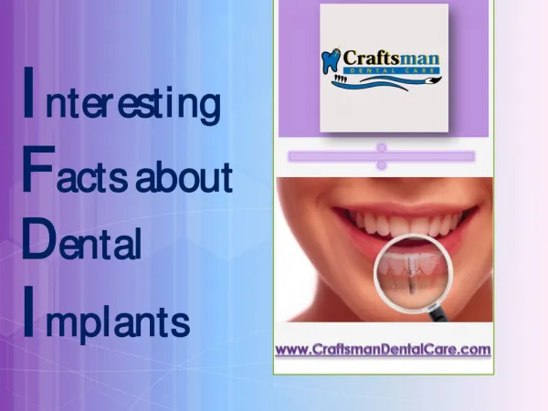 Interesting Facts about Dental Implants - Sacramento