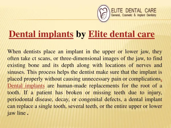 Best Dental implants by Elite dental care | Best emergency dental care