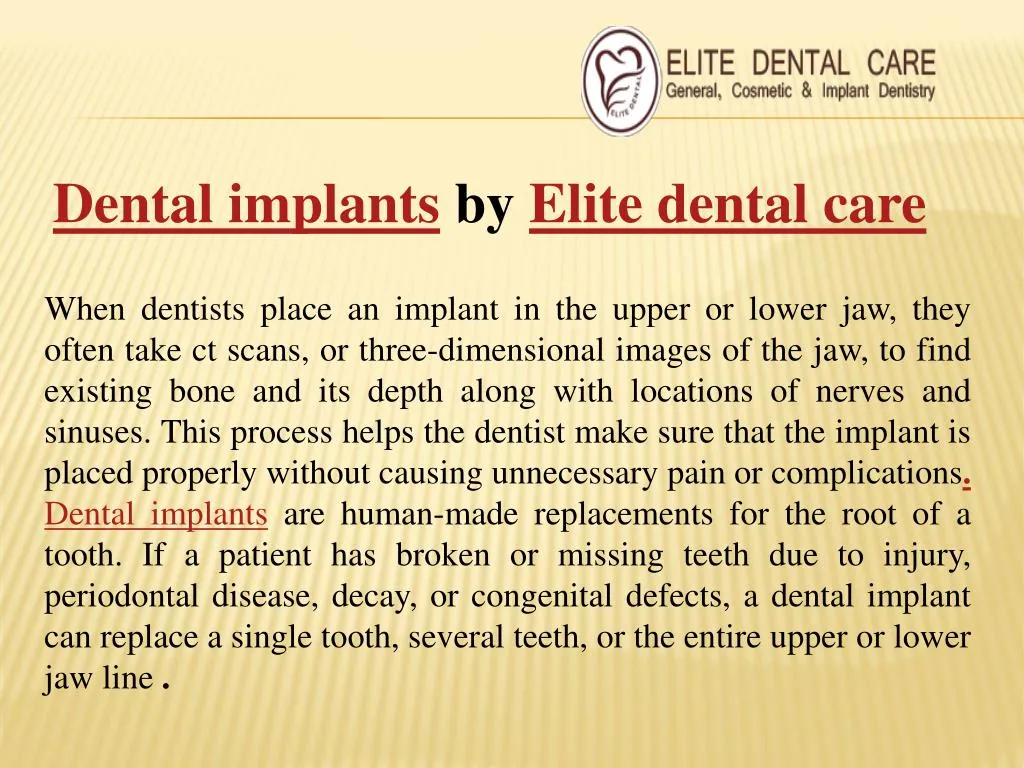 dental implants by elite dental care