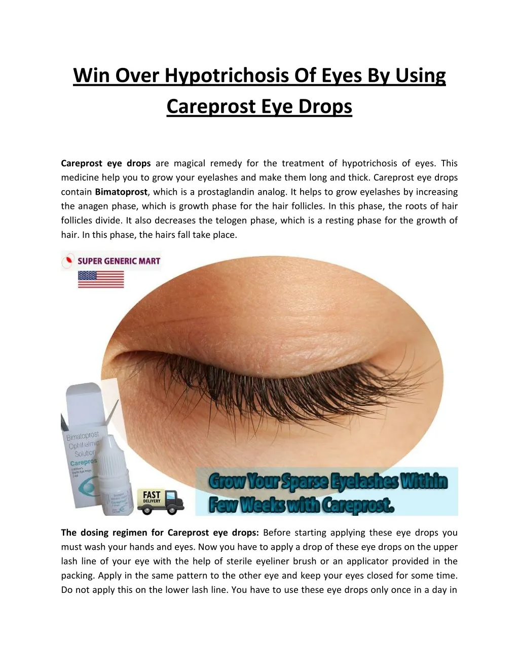 win over hypotrichosis of eyes by using careprost