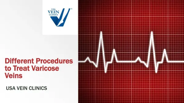 Varicose Veins Treatment Procedures - USA Vein Clinics
