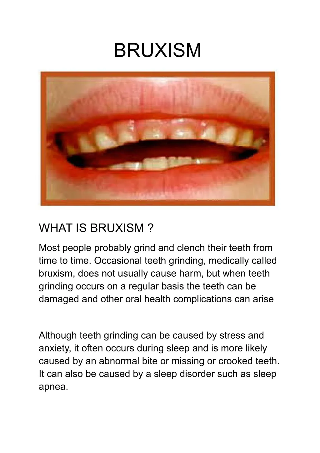 bruxism