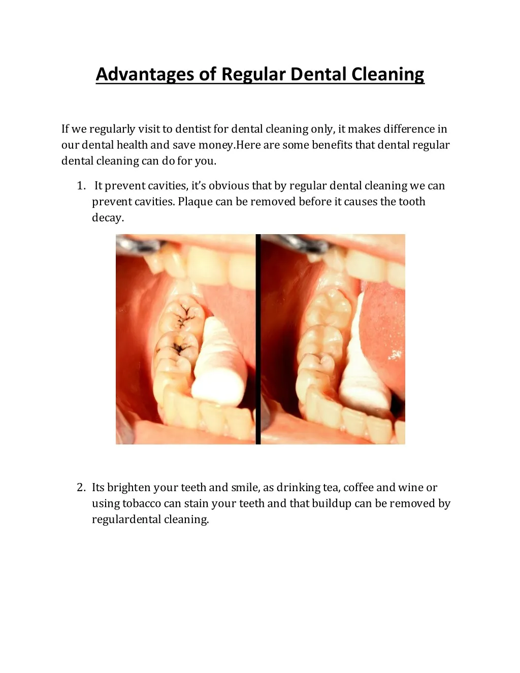 advantages of regular dental cleaning