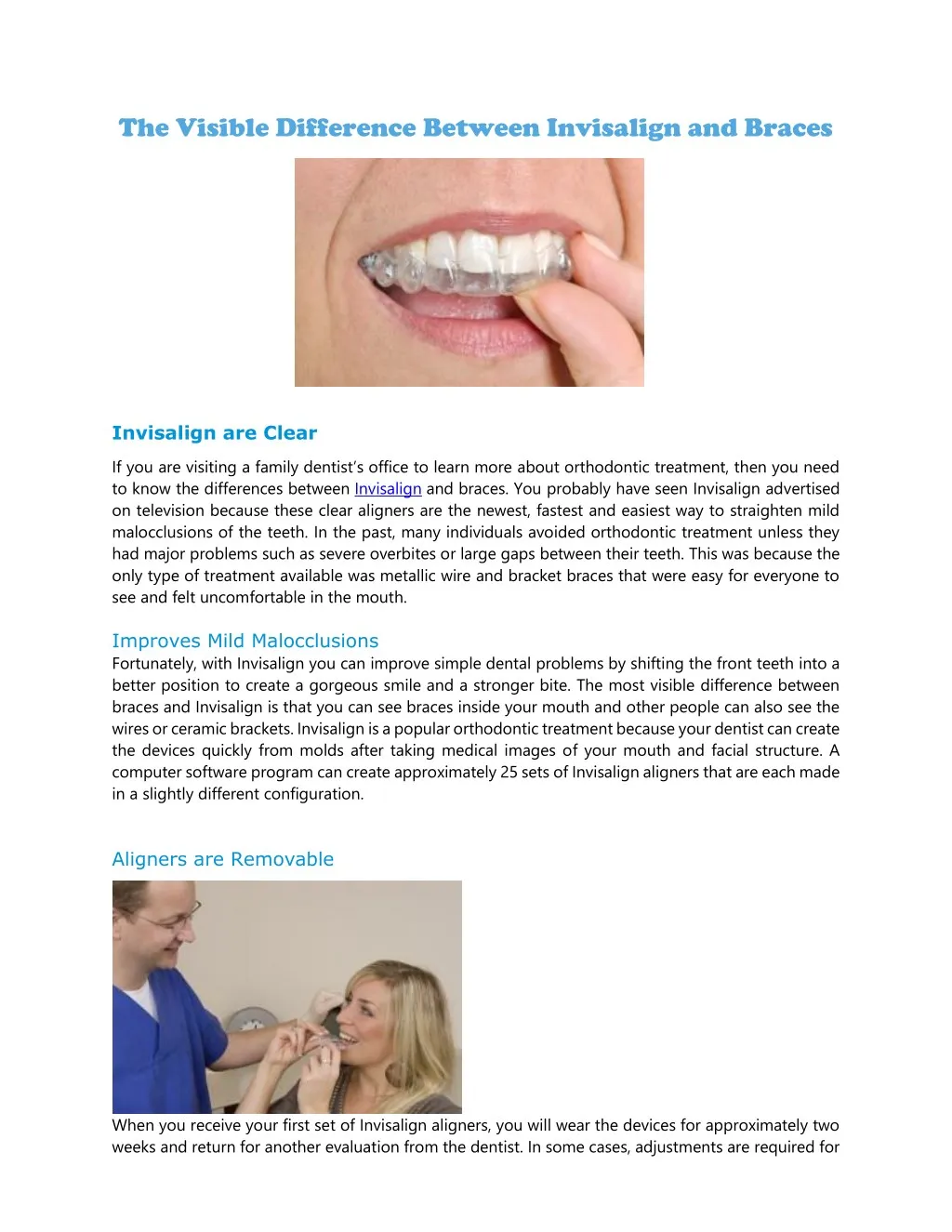 the visible difference between invisalign