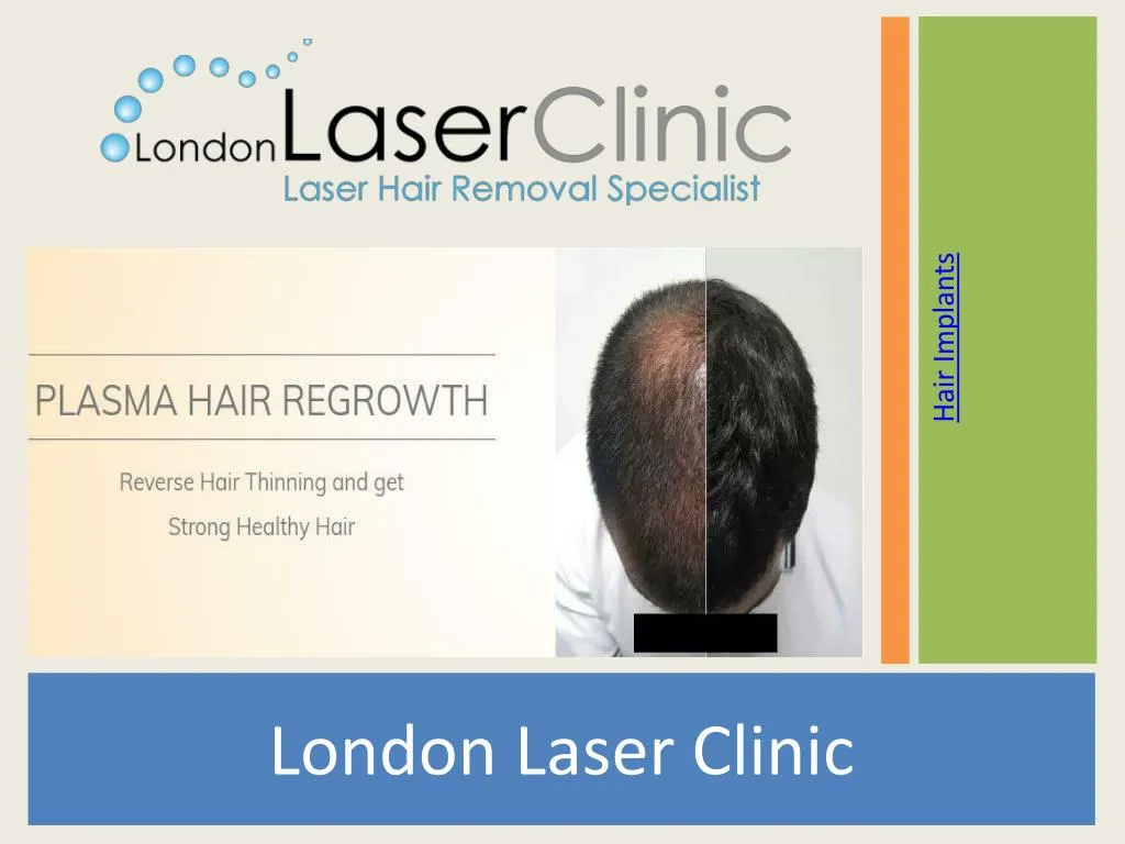 london laser clinic