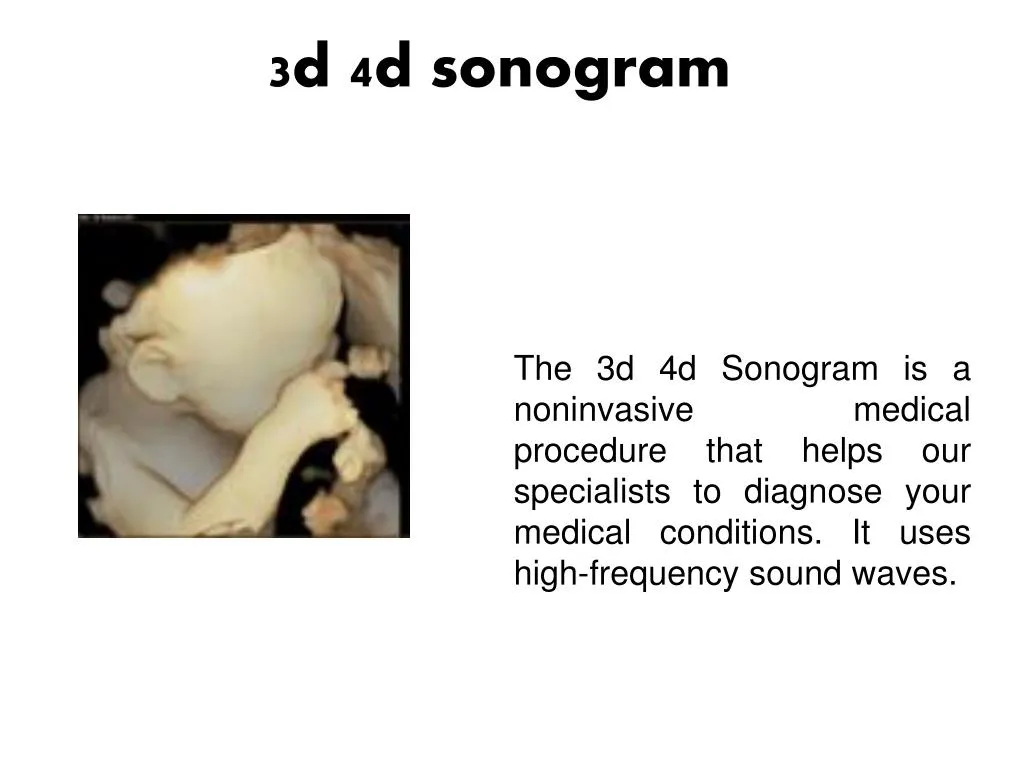 3d 4d sonogram
