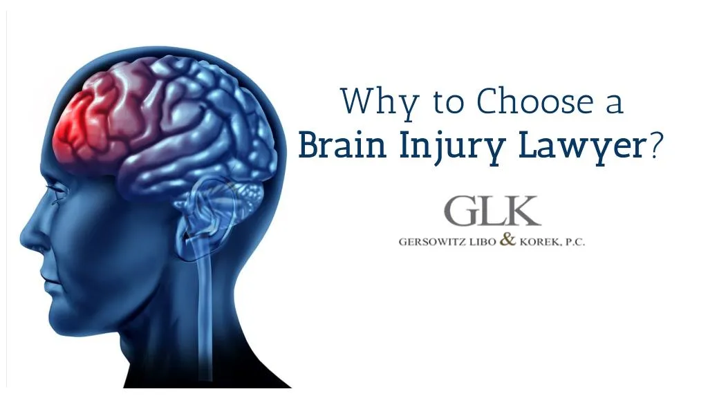 why to choose a brain injury lawyer