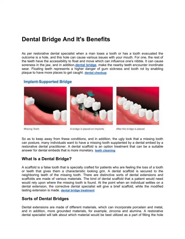 Dental Bridge And It's Benefits