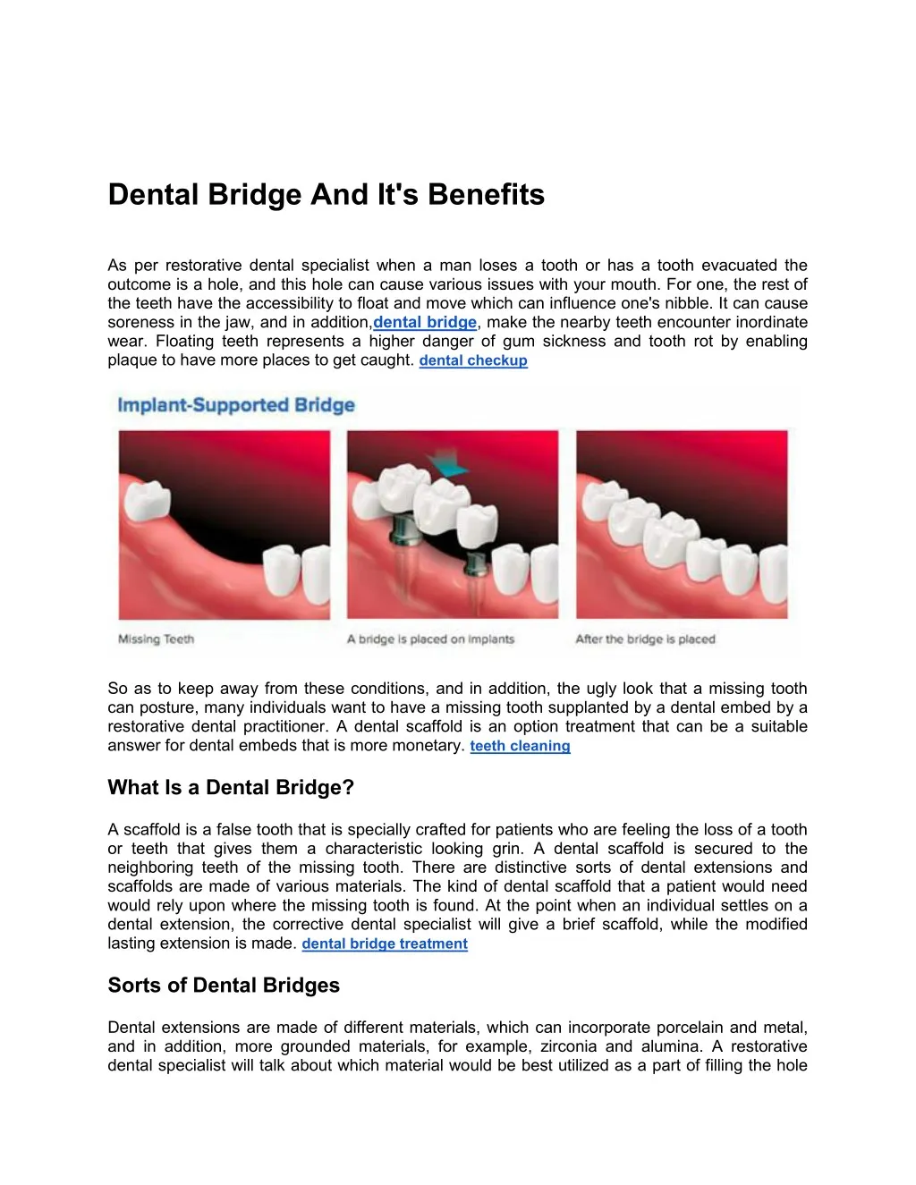 dental bridge and it s benefits