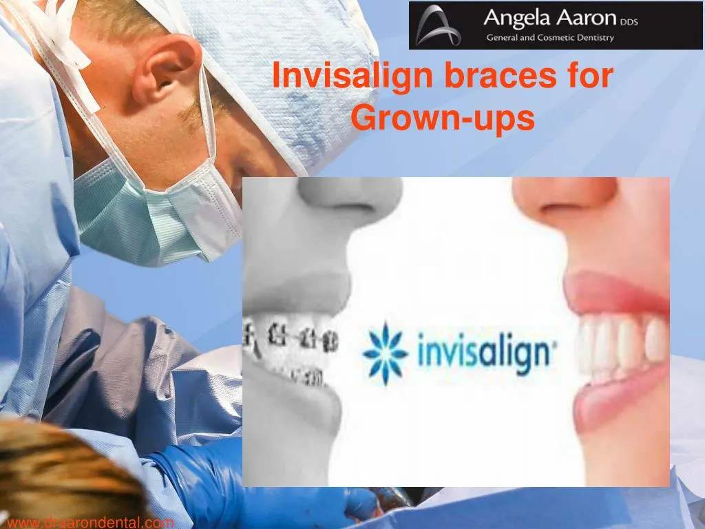 invisalign braces for grown ups