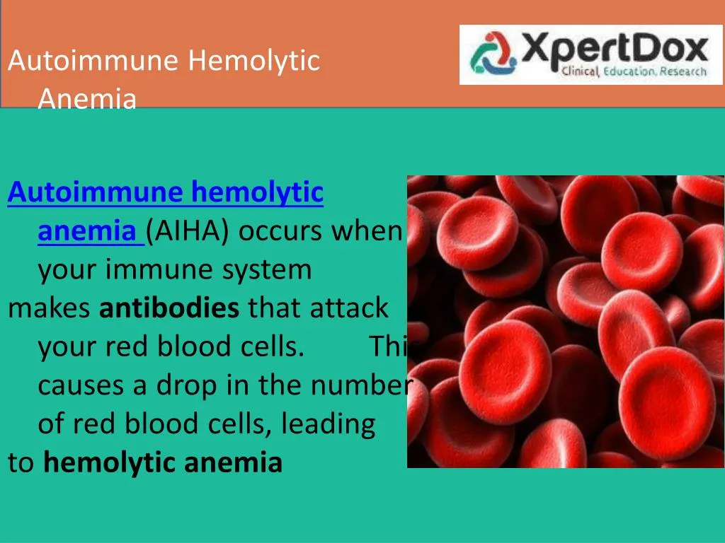 autoimmune hemolytic anemia autoimmune hemolytic