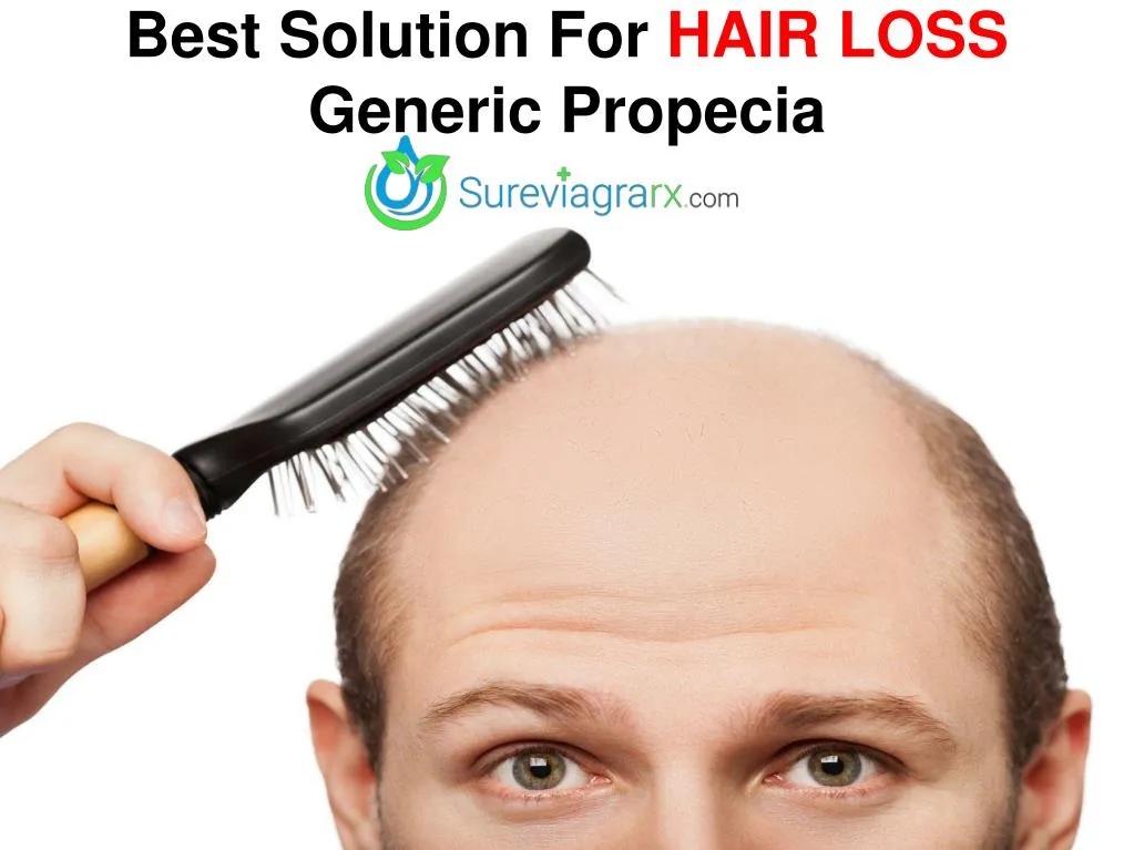 best solution for hair loss generic propecia
