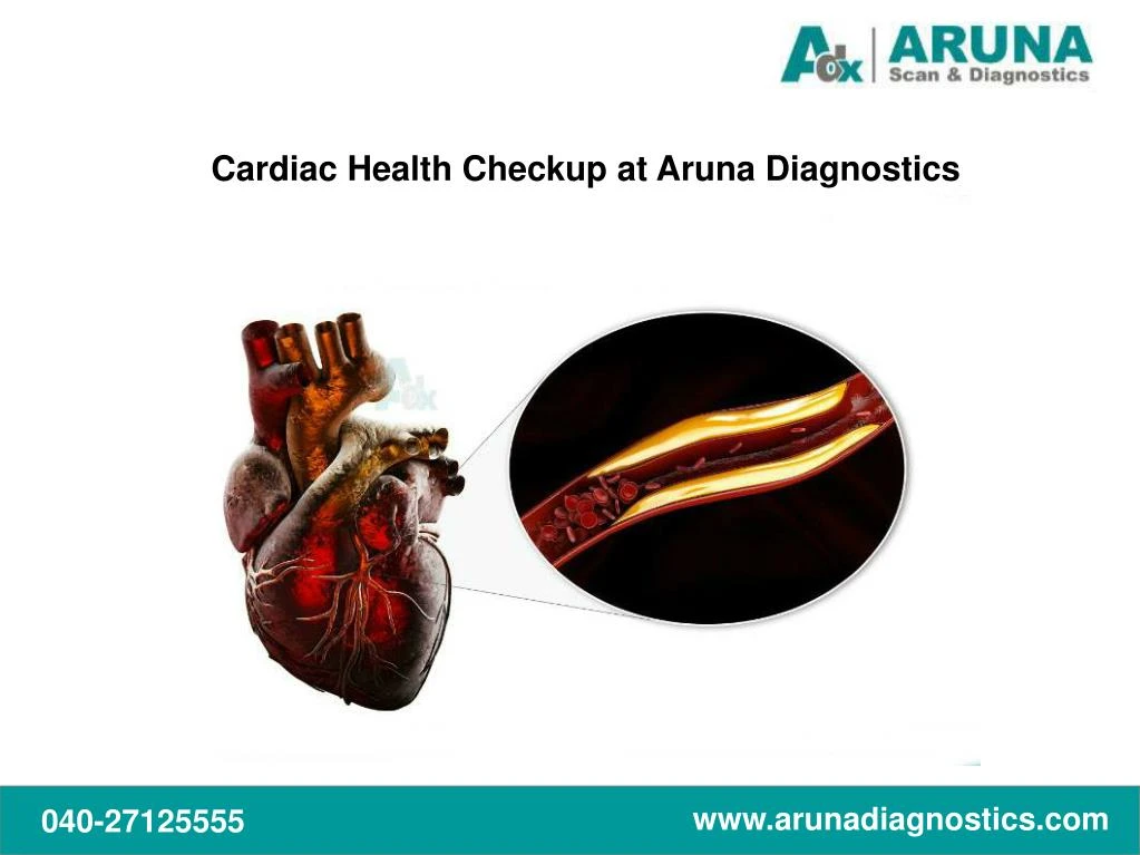 cardiac health checkup at aruna diagnostics