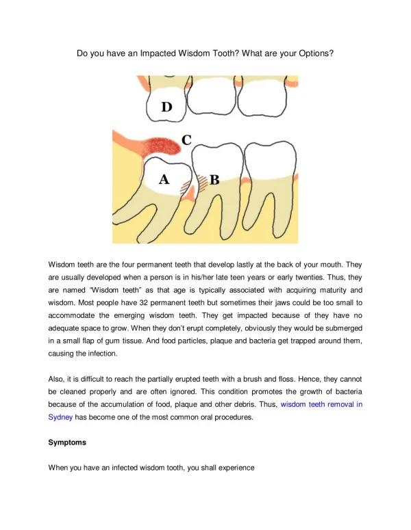Do you have an Impacted Wisdom Tooth? What are your Options?
