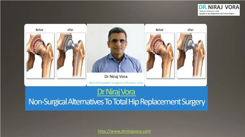 dr niraj vora non surgical alternatives to total hip replacement surgery