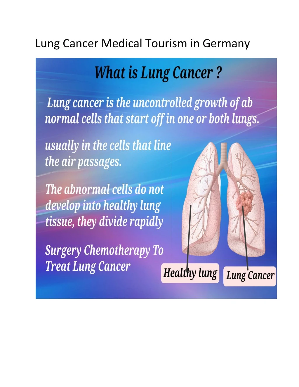 lung cancer medical tourism in germany