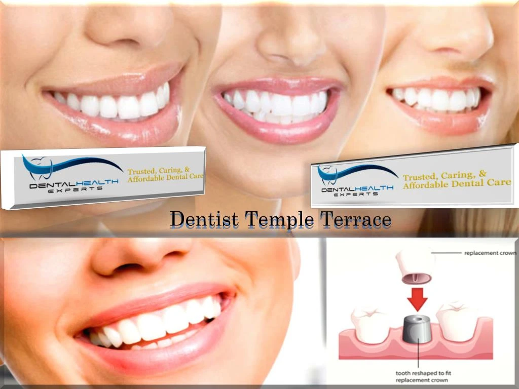 dentist temple terrace