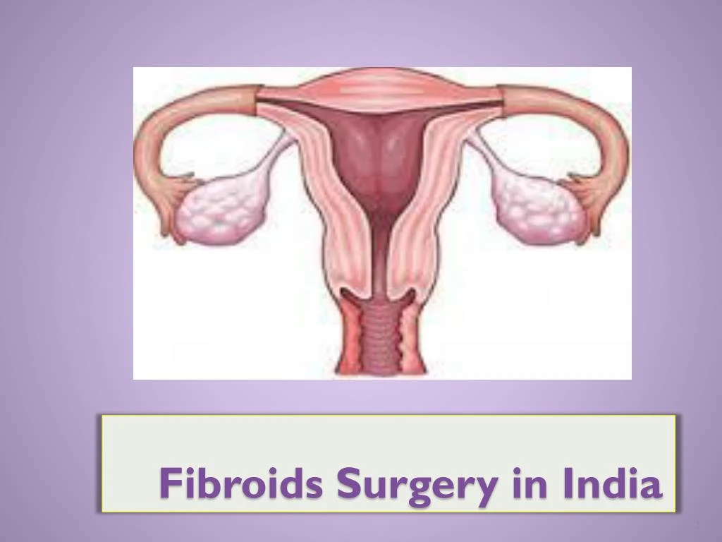 fibroids surgery in india