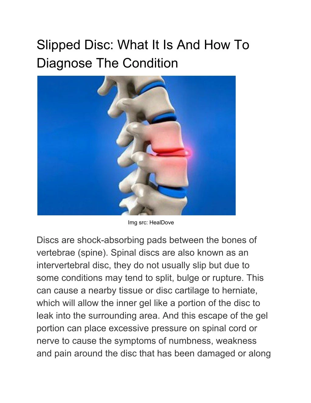 slipped disc what it is and how to diagnose