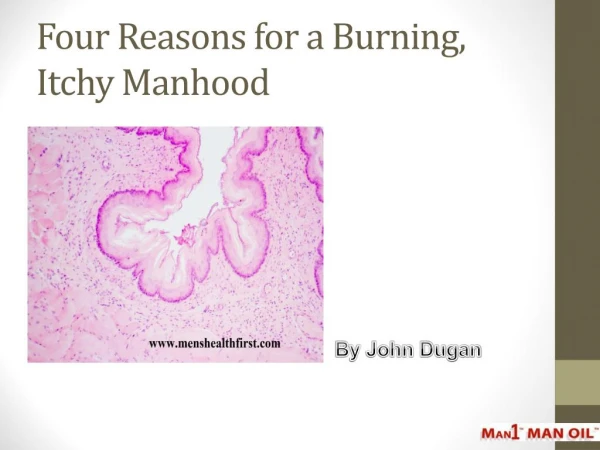 Four Reasons for a Burning, Itchy Manhood