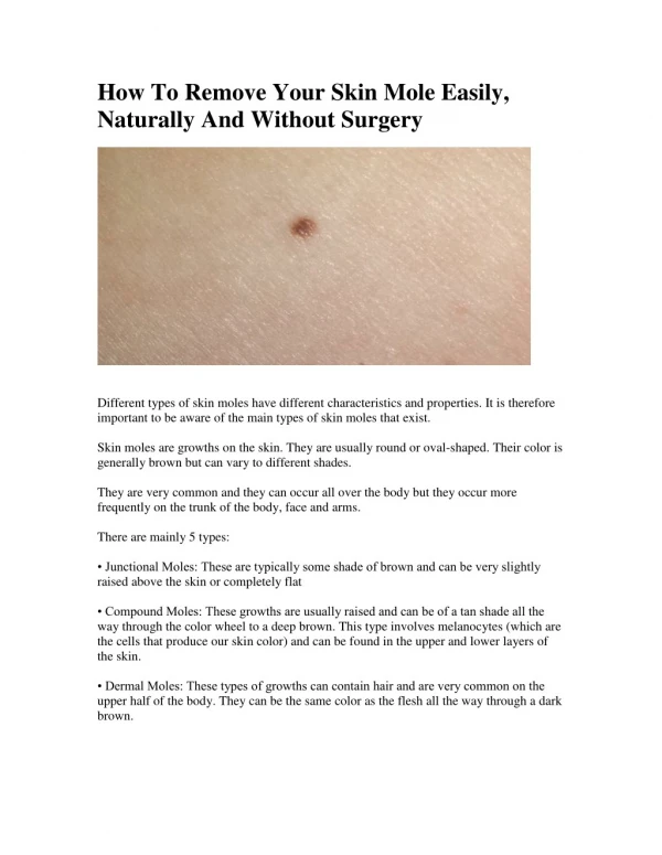 How To Remove Your Skin Mole Easily, Naturally And Without Surgery