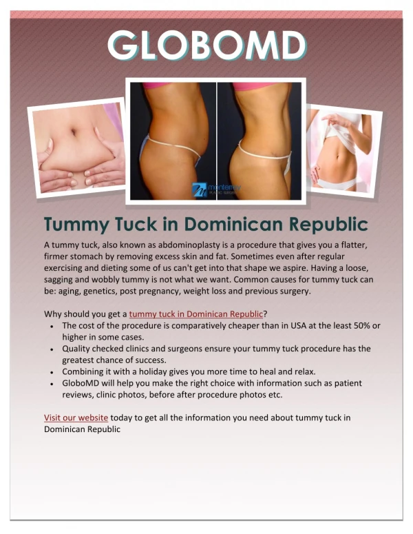 Tummy Tuck in Dominican Republic: GloboMD