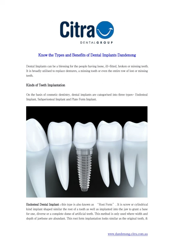 Know the Types and Benefits of Dental Implants Dandenong