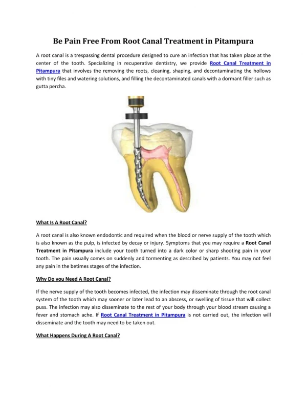 Be Pain Free From Root Canal Treatment in Pitampura