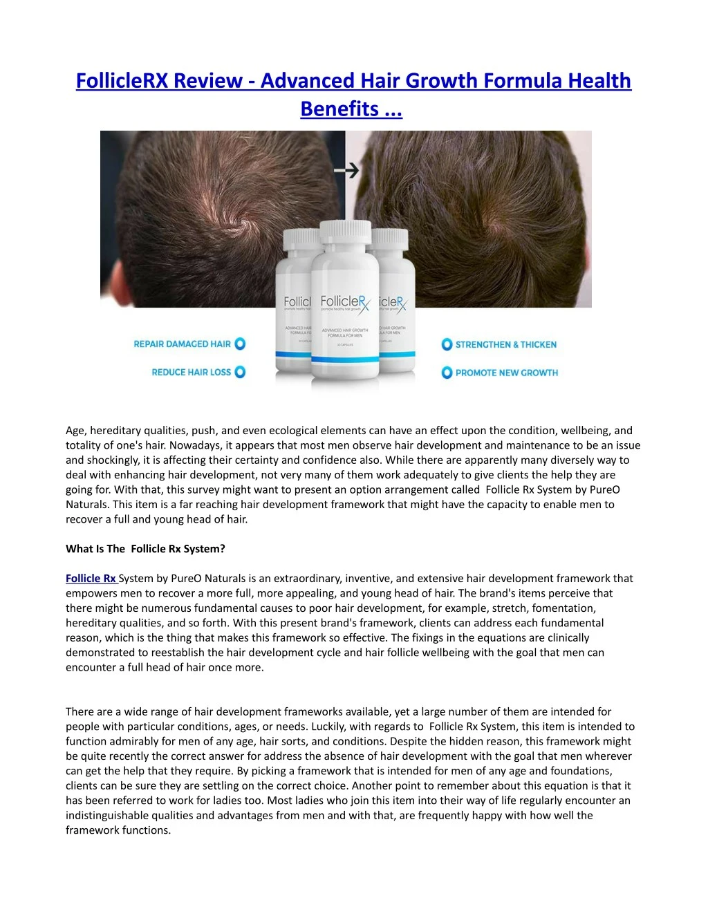folliclerx review advanced hair growth formula