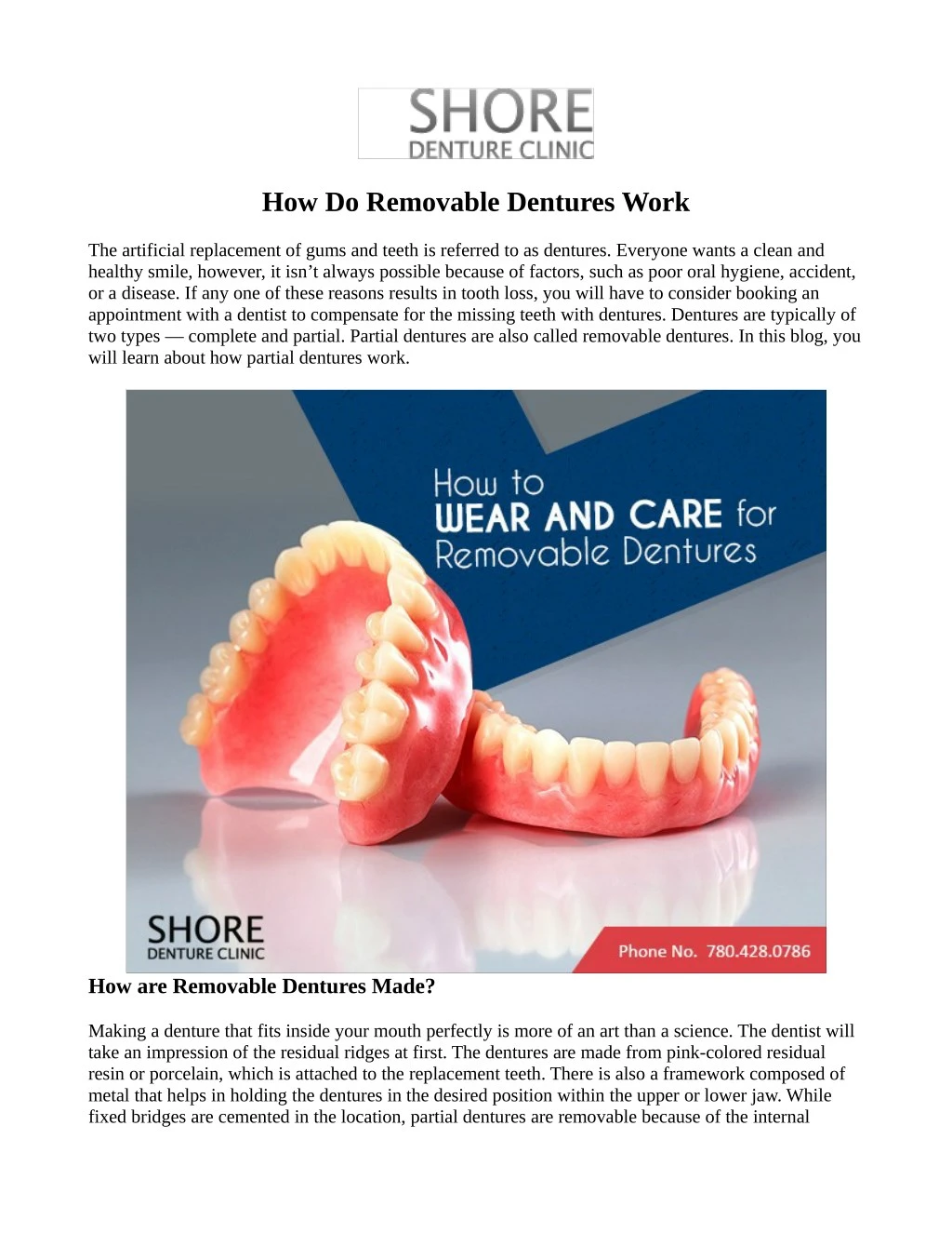 how do removable dentures work