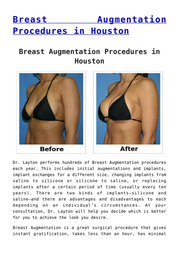 Breast Augmentation Procedures - Best Houston Plastic Surgeons