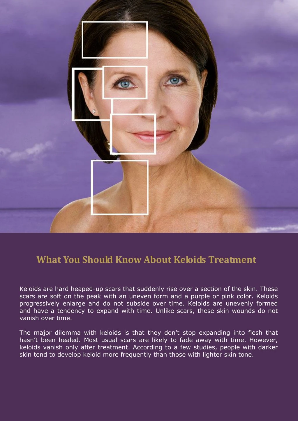 what you should know about keloids treatment
