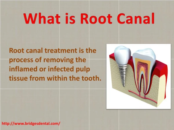 Dentist Lithia: Best Root Canal Treatment With Dr. Laura Bridges