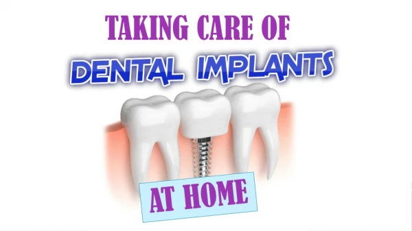Taking Care of Dental Implants at Home