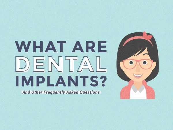 What Are Dental Implants and Other FAQs