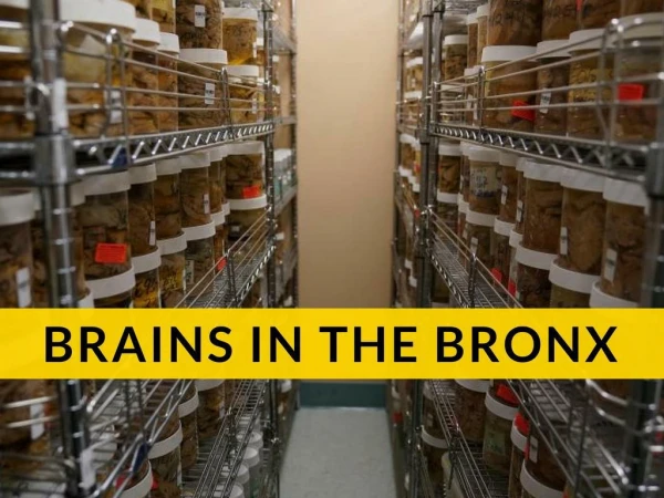 Brain Banker Who Keeps Thousands of Brains In His Lab In the Bronx