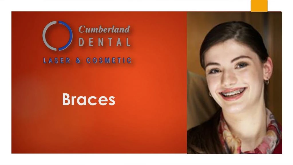 braces