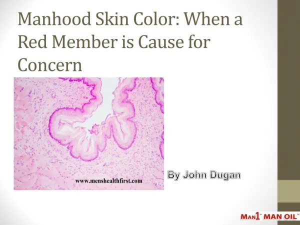 Manhood Skin Color: When a Red Member is Cause for Concern