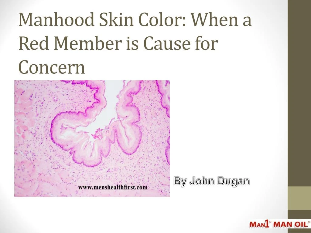 manhood skin color when a red member is cause for concern