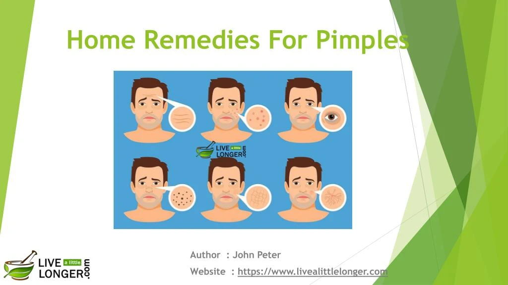 home remedies for pimples