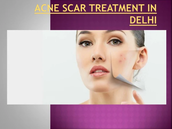 acne scar removal treatment in delhi