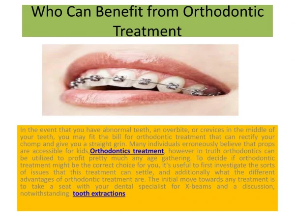 Orthodontics - Who Can Benefit from Orthodontic Treatment?