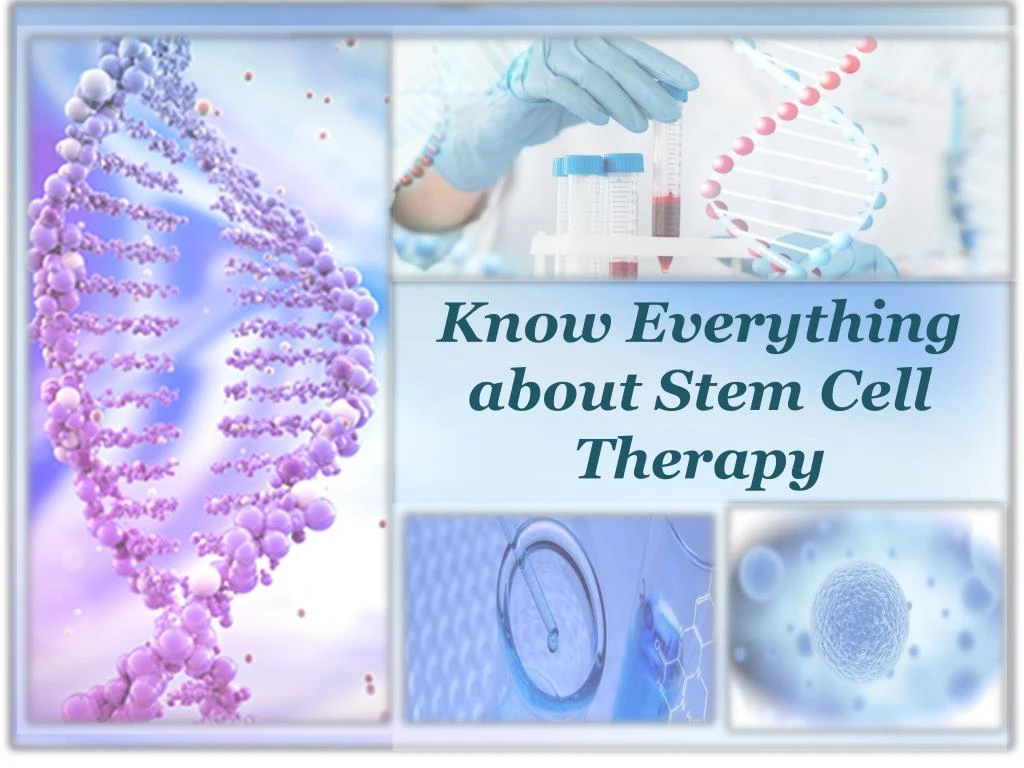 know everything about stem cell therapy