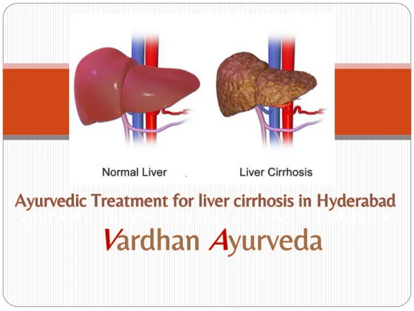 Ayurvedic Treatment for liver cirrhosis in Hyderabad | Vardhan Ayurveda