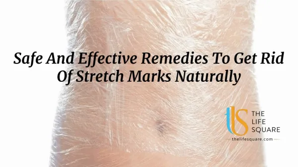Safe And Effective Remedies To Get Rid Of Stretch Marks Naturally