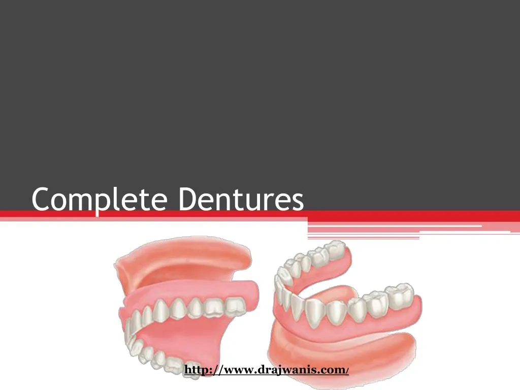 complete dentures