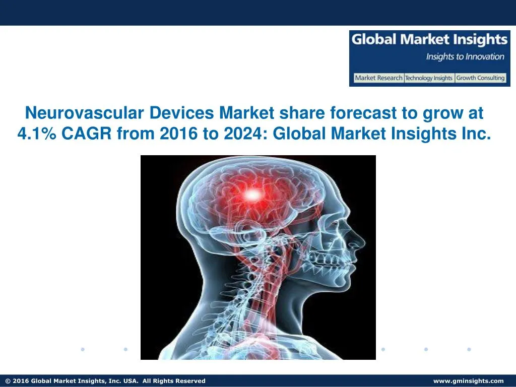 neurovascular devices market share forecast
