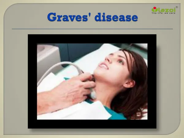 Graves' disease: Primary cause of hyperthyroidism