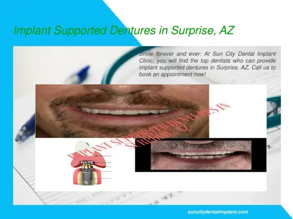 Implant Supported Dentures in Surprise, AZ