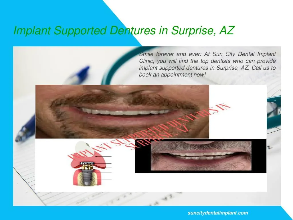 implant supported dentures in surprise az